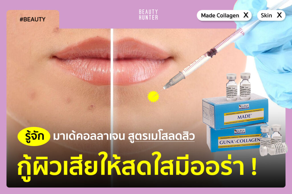 มาเด้คอลลาเจน สูตรเมโสลดสิว กู้ผิวเสียให้สดใสมีออร่า !